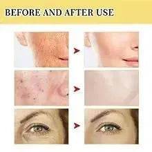 OUHOE Advanced Snail Mucin Power Essence Moisturizing Serum 100ml - EX-STOCK Canada