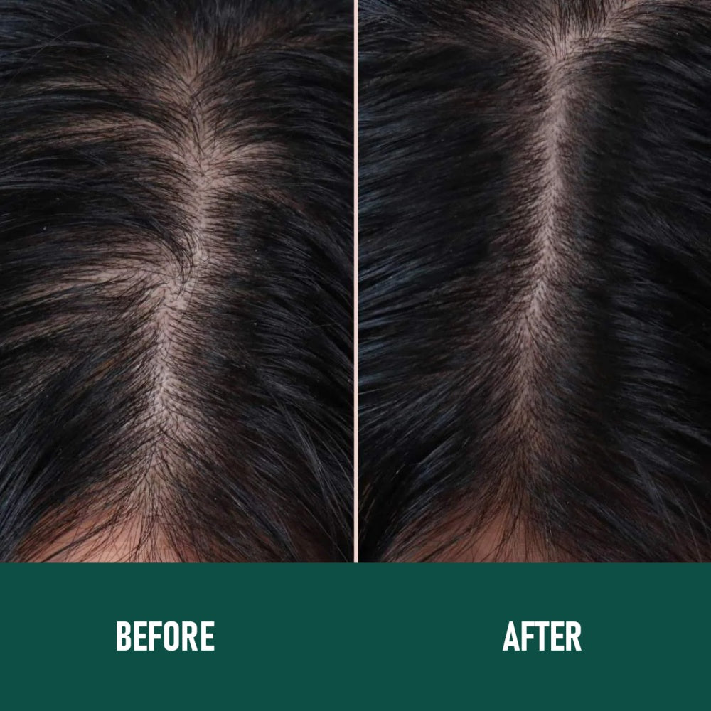 Before and after comparison of hair texture on a person's scalp.