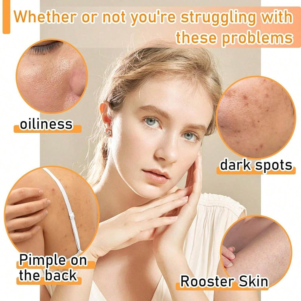 Body Face Brightening Turmeric Hyperpigmentation Bar Soap - EX-STOCK Canada