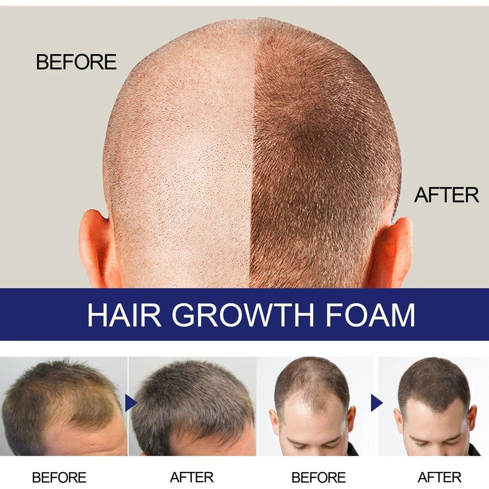 N Men's Dense Hair Foam Deep Repair Care EX-STOCK Canada