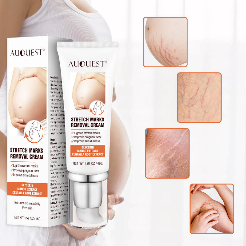 Remove Pregnancy Scars Acne Cream Stretch Mark Treatment Maternity Repair Anti-Aging Anti-Winkle Firming Body Cream EX-STOCK Canada