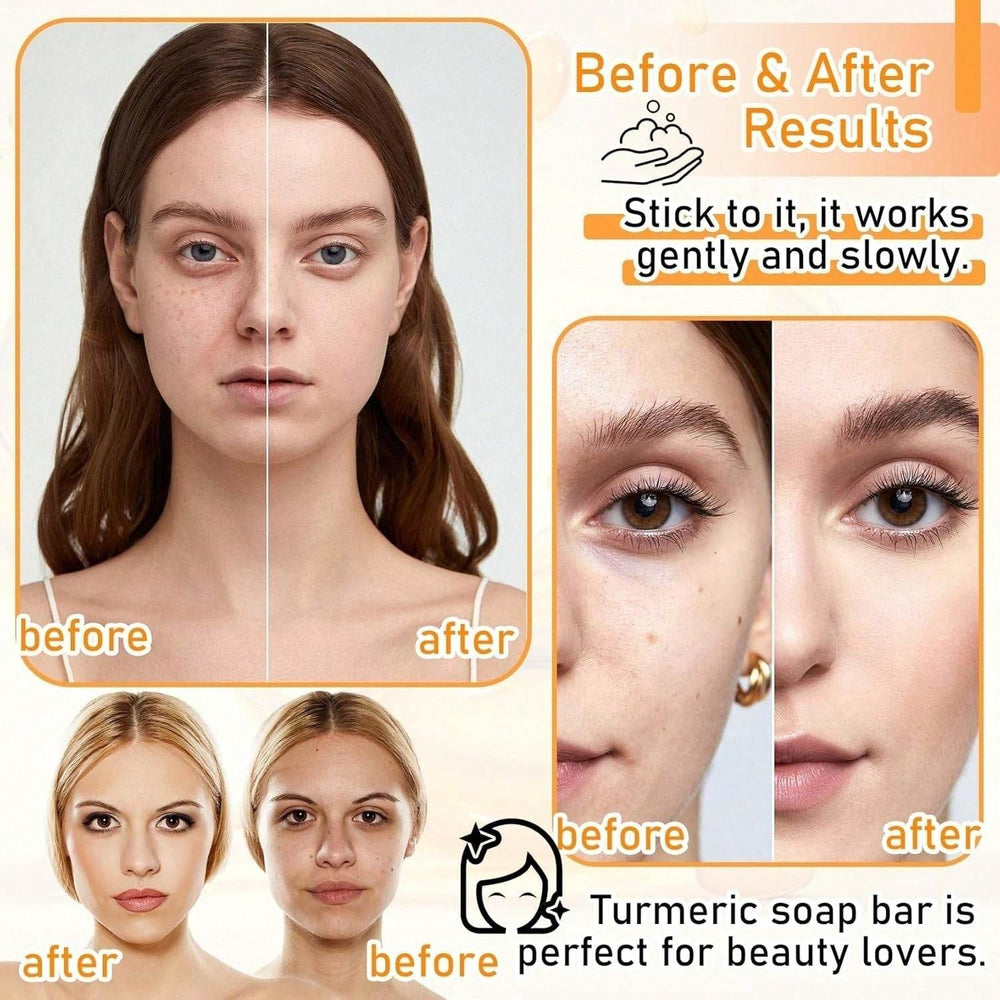 Body Face Brightening Turmeric Hyperpigmentation Bar Soap - EX-STOCK Canada