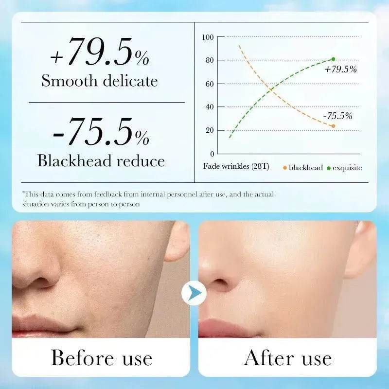 Aloe Pore Clear Solid Mask Cleaning - EX-STOCK Canada