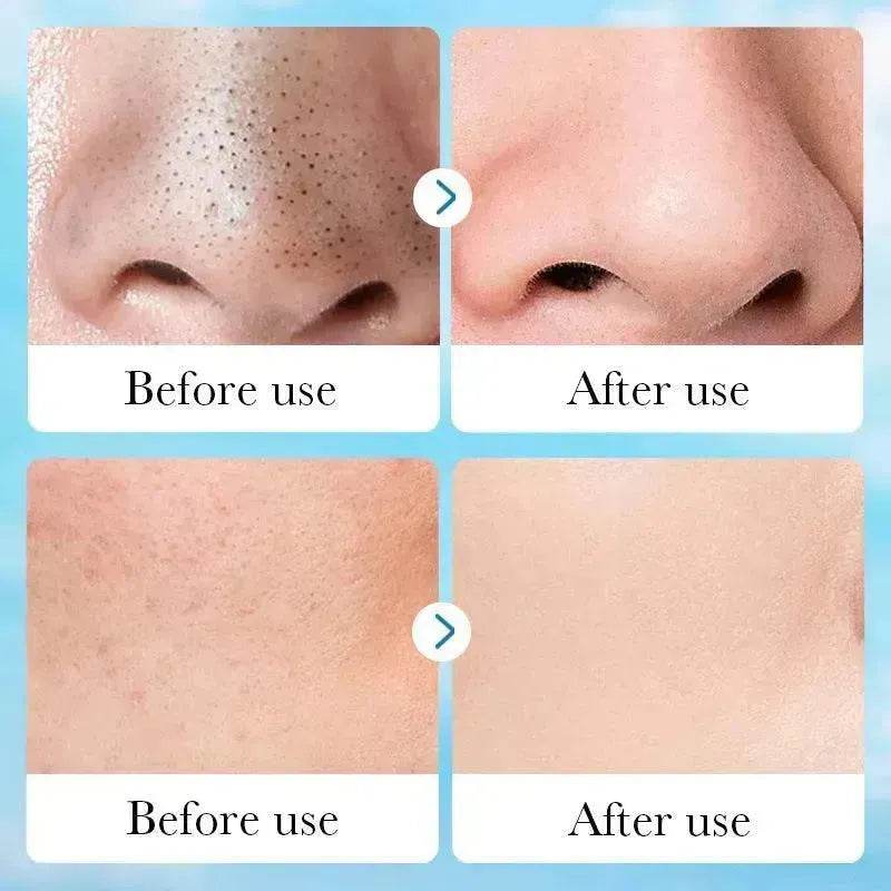 Aloe Pore Clear Solid Mask Cleaning - EX-STOCK Canada