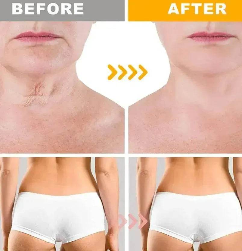 Crazylife Bee Venom Dual-purpose Body Face Repair Cream - EX-STOCK Canada