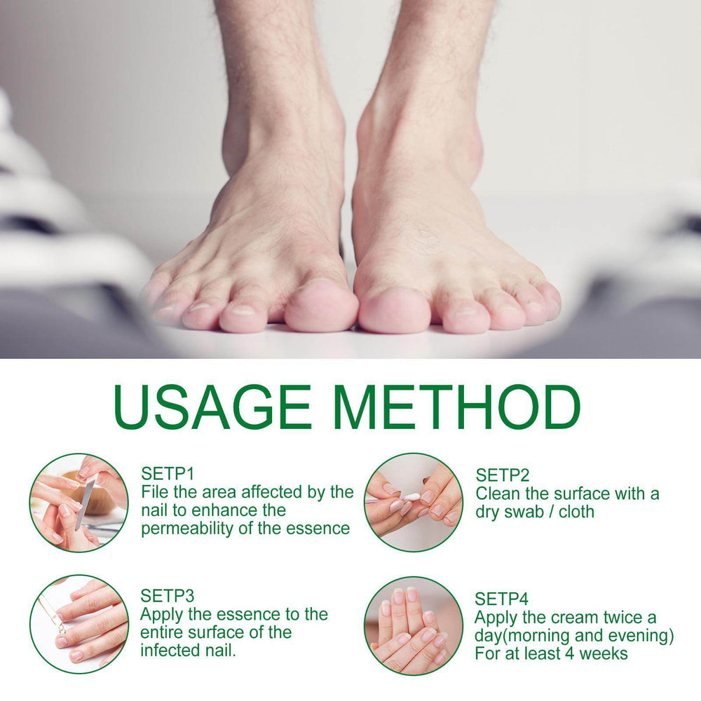 Jiasuying Ginger Nail Care Liquid, Repairs And Moisturizes Hand And Foot Nails, Makes Nails Shiny And Soft, And Improves Onychomycosis - EX-STOCK Canada