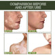 EELHOE White Spot Cleansing Serum PSORALCN White Spot Antibacterial Liquid. - EX-STOCK Canada