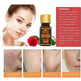 ELAIMEI Ultra Whitening Brightening Spotless Oil Freckles and Dark Spot Remover - EX-STOCK Canada