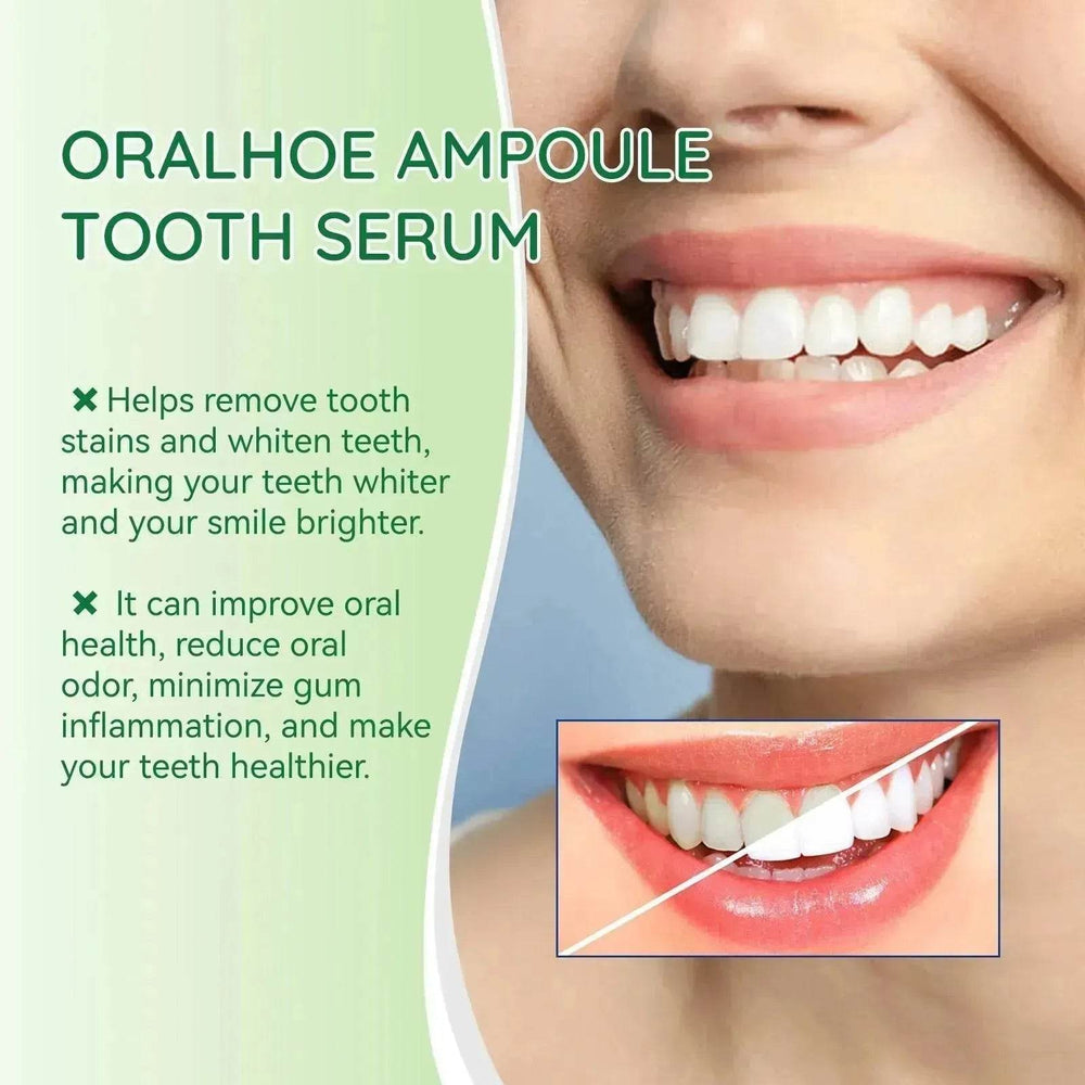 Teeth Whitening Liquid Deep Cleaning - EX-STOCK Canada