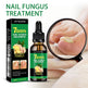 Jiasuying Ginger Nail Care Liquid, Repairs And Moisturizes Hand And Foot Nails, Makes Nails Shiny And Soft, And Improves Onychomycosis EX-STOCK