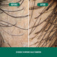 Before and after comparison of scalp with hair growth improvement over 20 weeks.