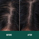 Before and after comparison of hair texture on a person's scalp.