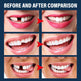 Denture Decorative Teether Set, Halloween Vampire Makeup Dress Up Fake Tooth Glue Teeth Props - EX-STOCK Canada