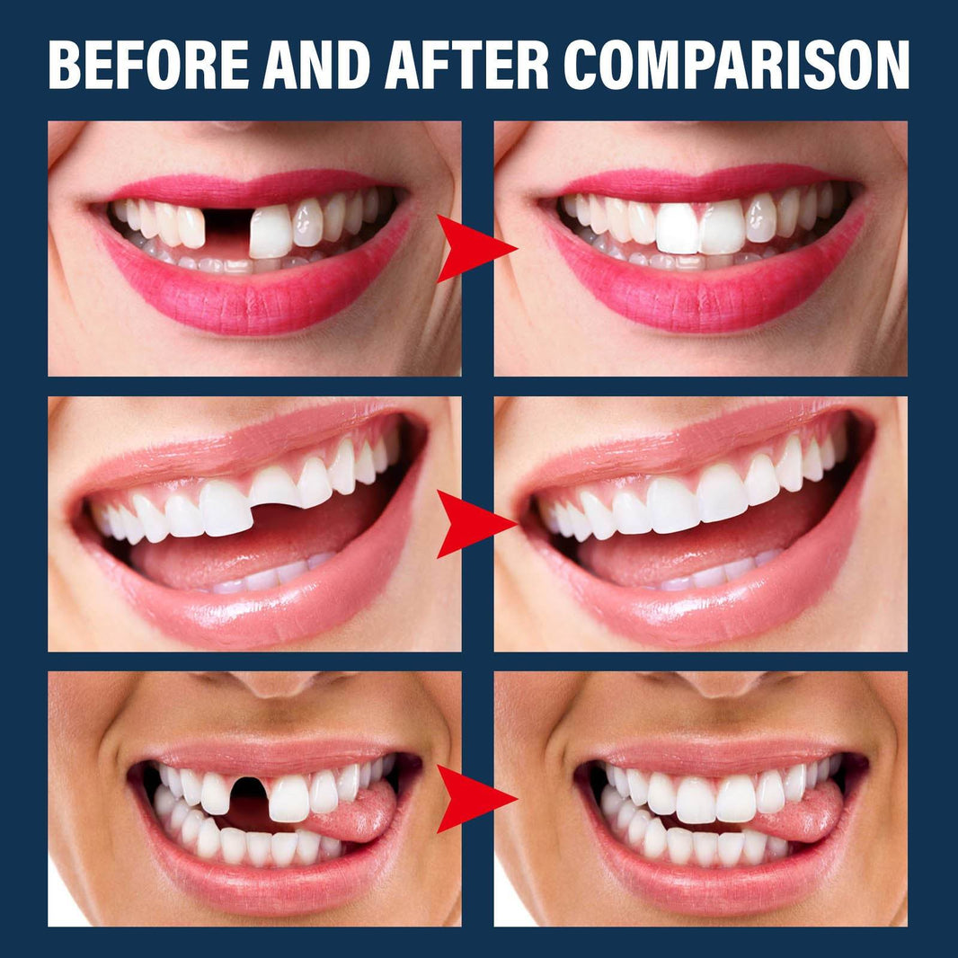 Denture Decorative Teether Set, Halloween Vampire Makeup Dress Up Fake Tooth Glue Teeth Props EX-STOCK
