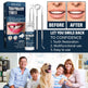 Denture Decorative Teether Set, Halloween Vampire Makeup Dress Up Fake Tooth Glue Teeth Props - EX-STOCK Canada