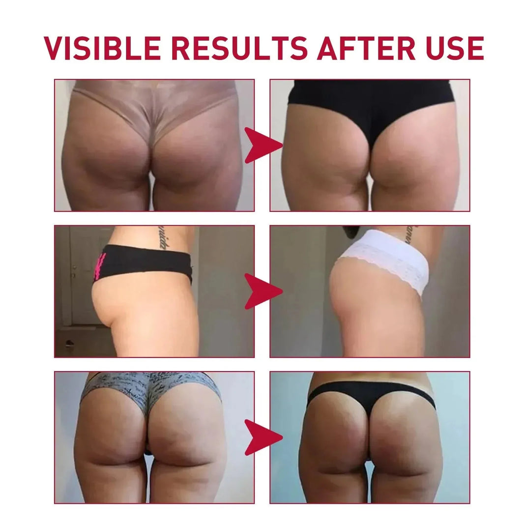 Plump Buttock Cream Lifts And Tightens Buttocks - EX-STOCK CANADA