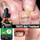 7DAYS Nail Fungus Treatment Serum Care Hand And Foot Care Removal - EX-STOCK CANADA