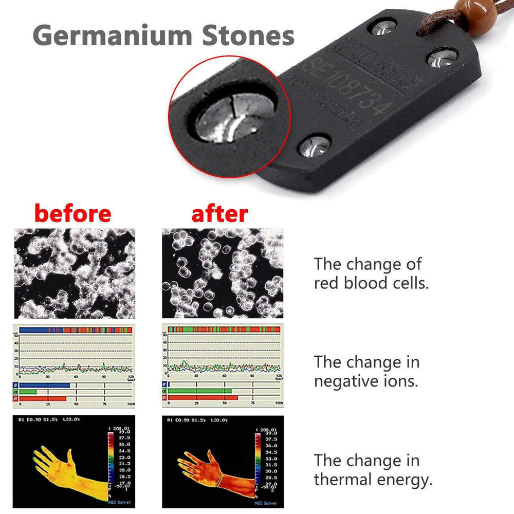 Anti-EMF Radiation Protection Necklace – Negative Ion Wellness Pendant