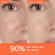 Before and after comparison of skin texture with text indicating improvement.