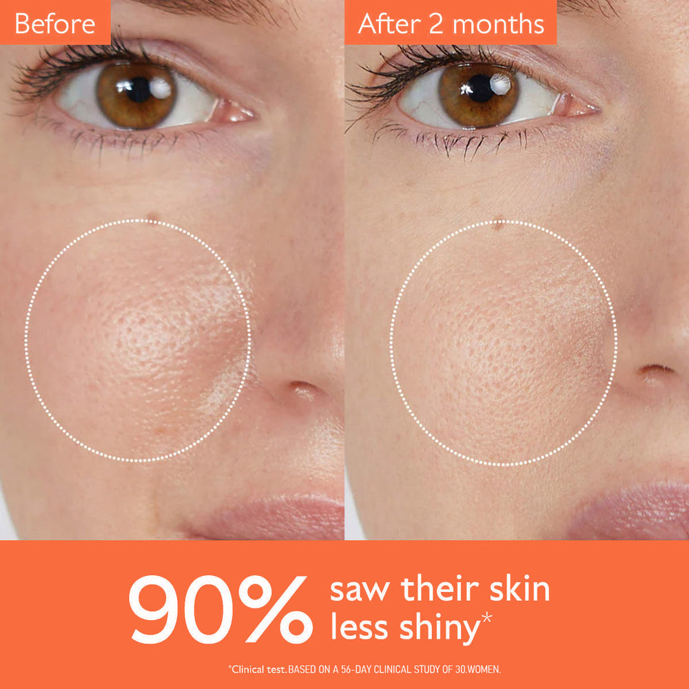 Before and after comparison of skin texture with text indicating improvement.