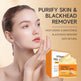Ginger Kojic Acid Turmeric VC Mask EX-STOCK