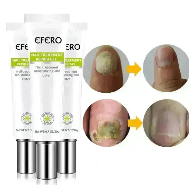 nail treatment serum