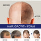 N Men's Dense Hair Foam Deep Repair Care EX-STOCK Canada 