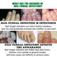 Jiasuying Ginger Nail Care Liquid, Repairs And Moisturizes Hand And Foot Nails, Makes Nails Shiny And Soft, And Improves Onychomycosis EX-STOCK