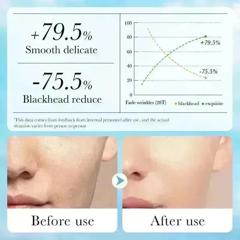 Aloe Pore Clear Solid Mask Cleaning - EX-STOCK CANADA
