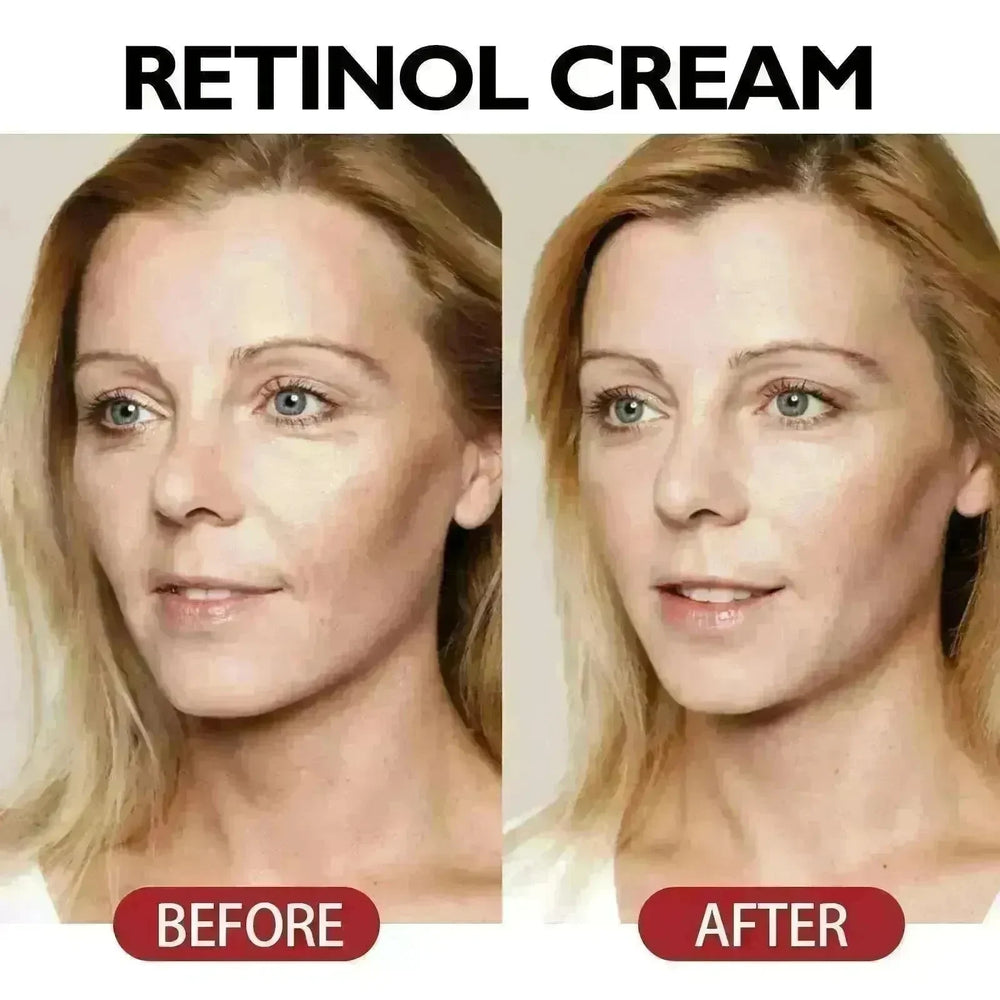 Anti-Aging Nourishing And Firming Skin Anti-wrinkle Face Cream - EX-STOCK CANADA