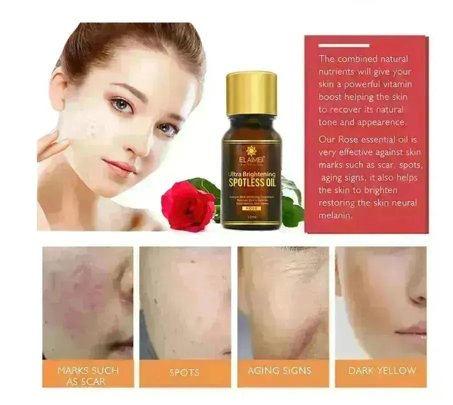 ELAIMEI Ultra Whitening Brightening Spotless Oil Freckles and Dark Spot Remover - EX-STOCK CANADA