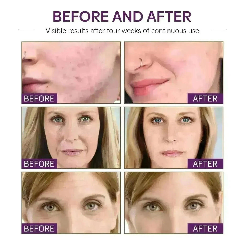 Face Moisturizing Cream Firming Moisturizing Skin Anti-wrinkle - EX-STOCK CANADA