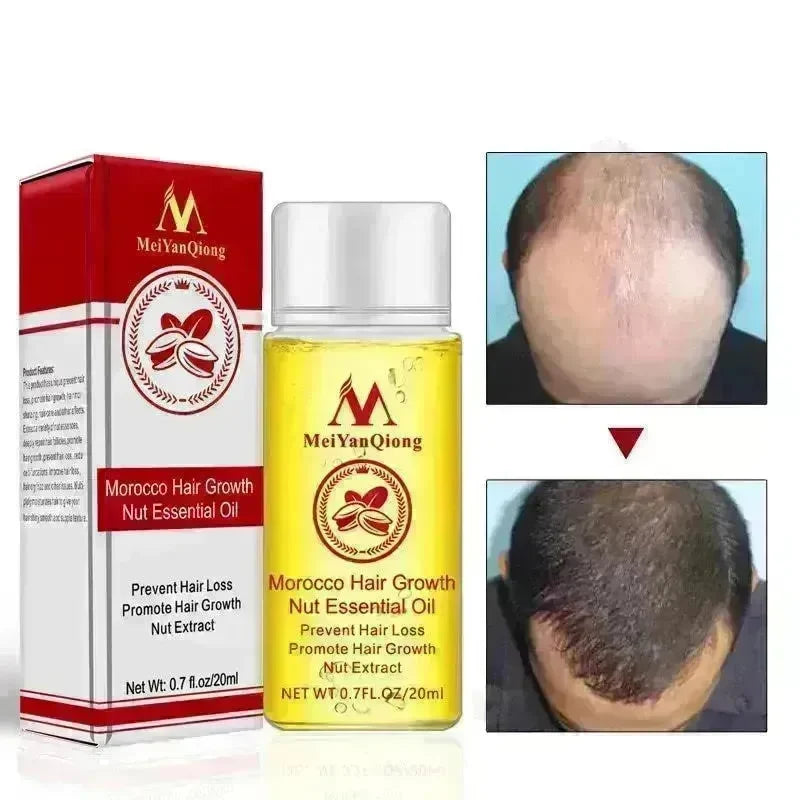 Hair Care Essential Oil , Promote Hair Growth, Shinny smooth texture, Moisturizes hair - EX-STOCK CANADA
