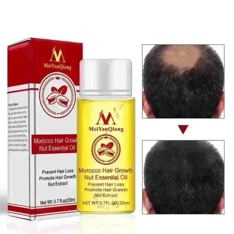 Hair Care Essential Oil , Promote Hair Growth, Shinny smooth texture, Moisturizes hair - EX-STOCK CANADA